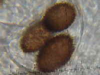 T melanosporum - Sporen_1